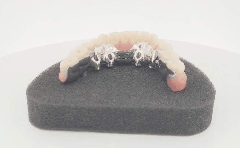Prothese resine sur implant