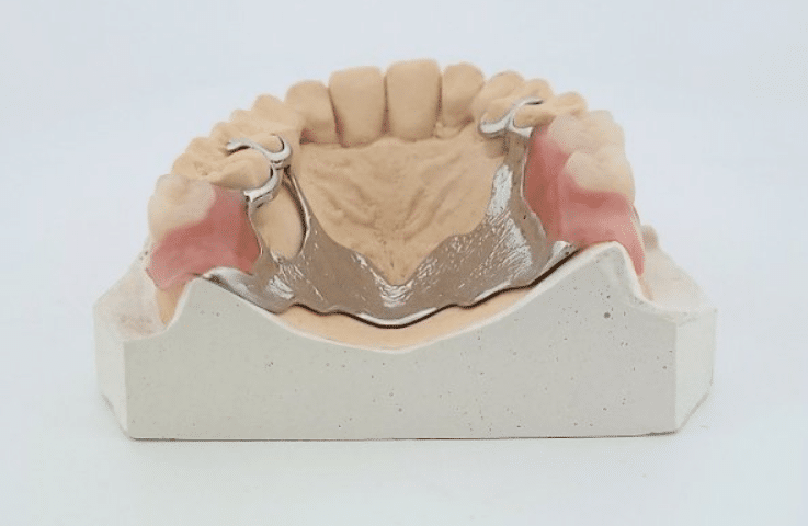 Stellitte de 1 a 14 dents dents
