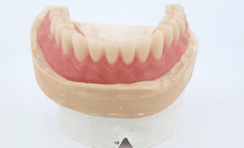 appareil resine de 1 a 14 dents LaFabrique du prothesiste