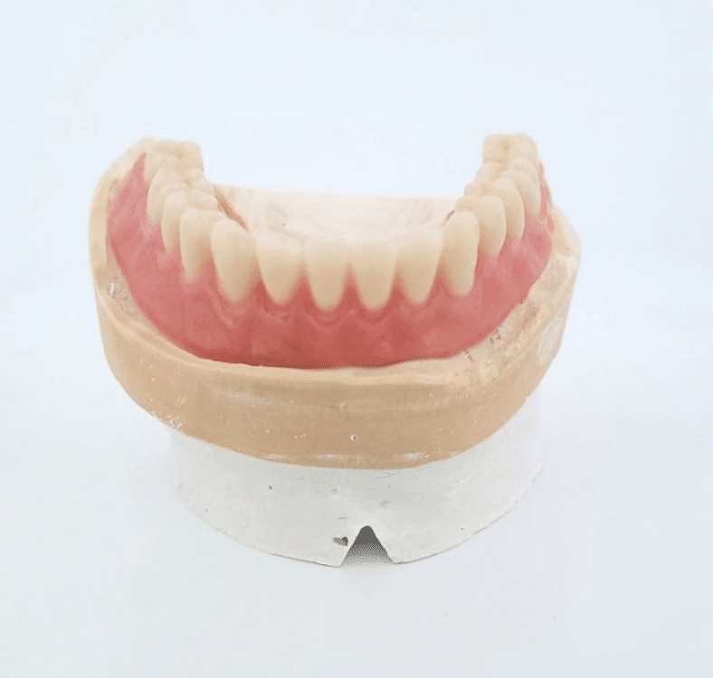 appareil resine de 1 a 14 dents LaFabrique du prothesiste