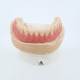 appareil resine de 1 a 14 dents LaFabrique du prothesiste